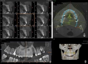 radiologia dentale Alemanno A. Tricase 2