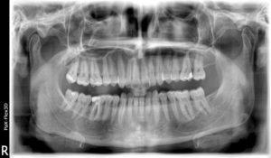 radiologia dentale Alemanno A