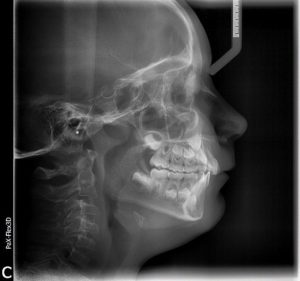 radiologia dentale Alemanno A. Tricase